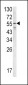 FIBB Antibody (N-term)